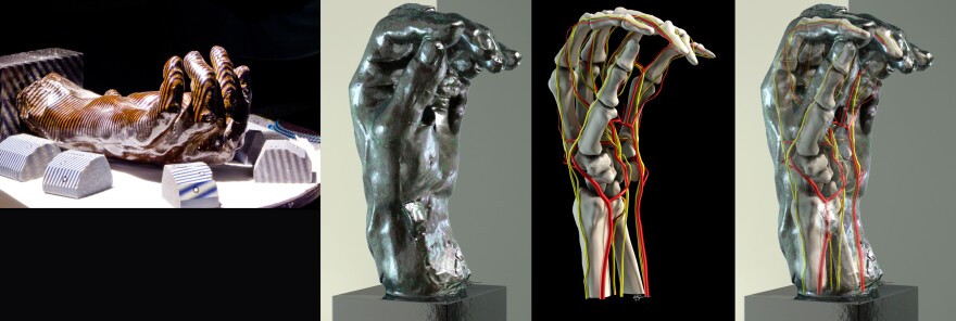 Rodin's <em>Left Hand of Eustache de St. Pierre</em>, during the scanning process (from left); computer image created from the scan; inner anatomy; and exterior scan and inner anatomy combined for an augmented reality view of the sculpture.