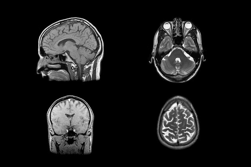 Brain scans