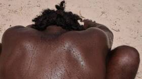 Beads of sweat drips down the back of David Hicks, 46, a Miami Beach resident and DJ, after working out at the My Equilibra, a Miami Beach wellness park in August 2023. Especially if exercising outside, remember to drink plenty of water.