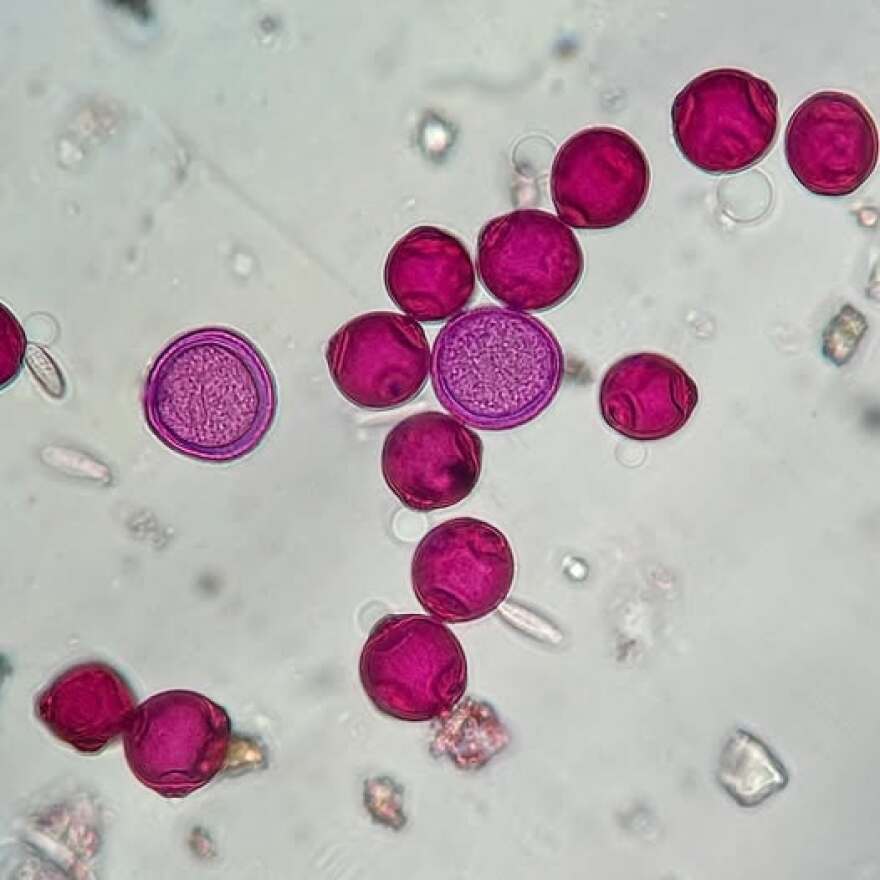 Birch pollen grains.