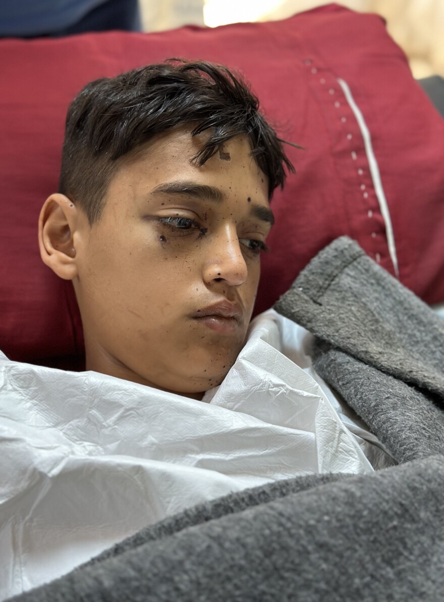 Fourteen-year-old Mohammed Abu Samur found what he thought was a bottle of perfume or deodorant. He lost his left hand below the elbow, and all the fingers on his right hand.