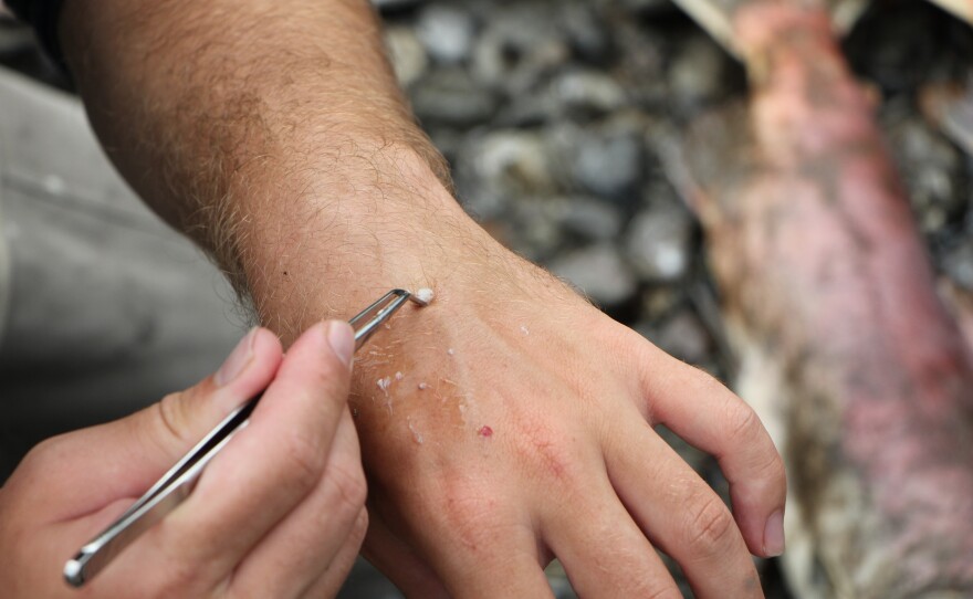 A University of Washington researcher displays the otolith with tweezers in August 2019.