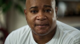 Glenn Johnson, 55, was injured in a smelting accident near Amarillo in 1997 in which a furnace filled with molten metal exploded, crushed him and left major burns over 90 percent of his body. 