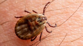 Infectious Encephalitis Tick on Skin.