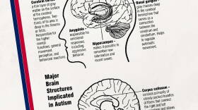 Autism brain