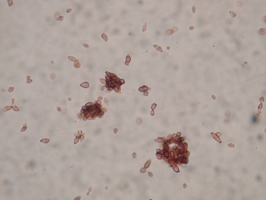 magnified mold spores