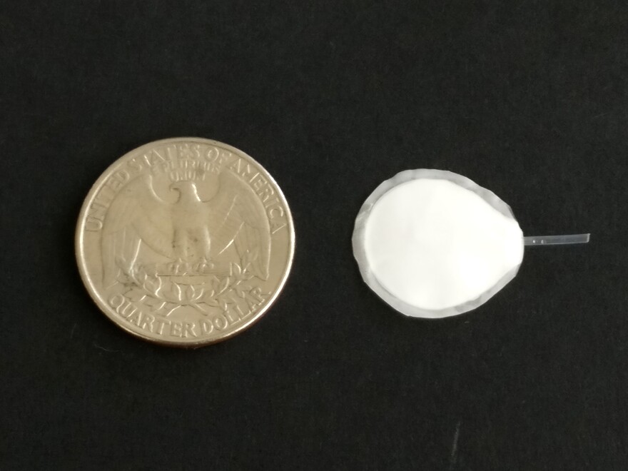 A coin-sized, semipermeable pouch is key to the proposed implant. The pouch allows cells inside to thrive and release insulin, the researchers say, while protecting the cells from immune rejection.