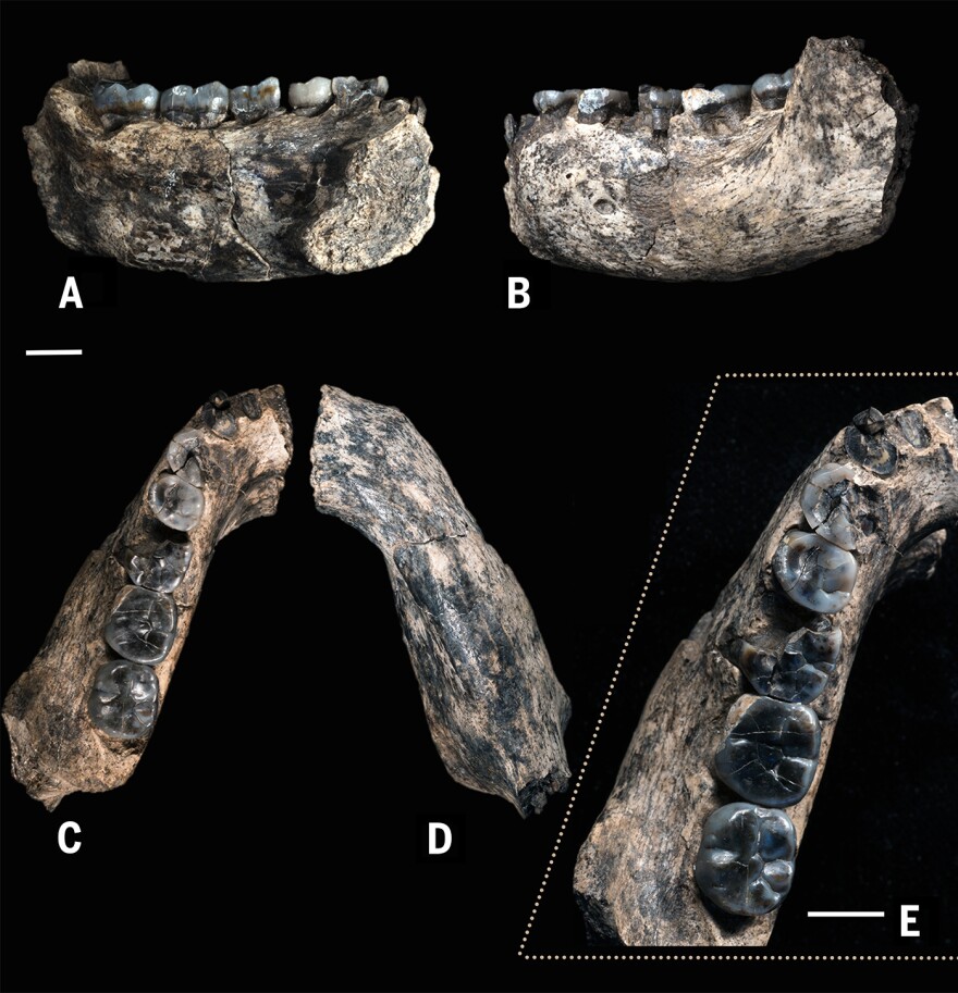 Five views of the fossilized jawbone highlight teeth that are becoming more slender, scientists say, relative to the blocky, more apelike teeth of <em>Australopithecus.</em>