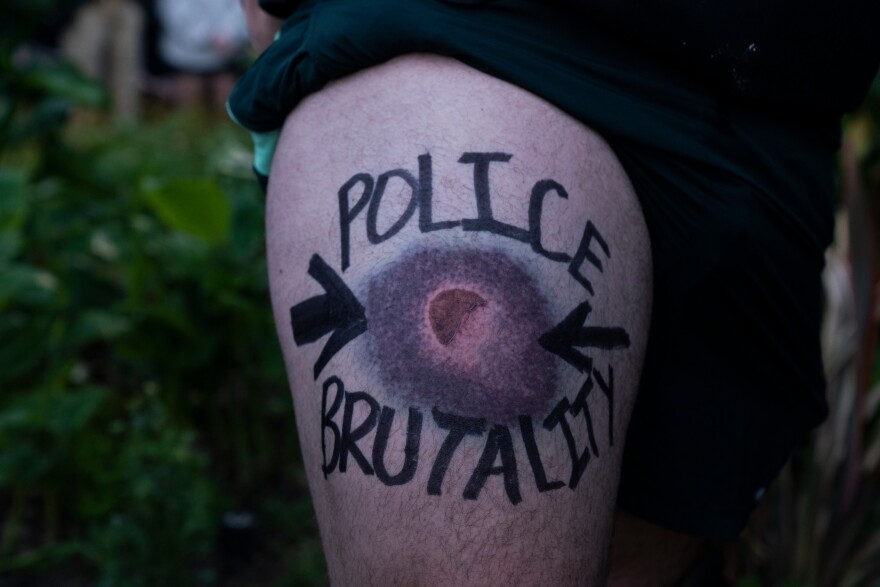 06042020-LessLethal-bruise-JonathanLevinson-OPB.jpg