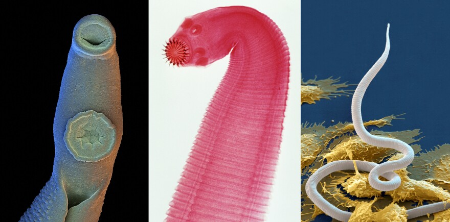 Three parasitic worms (from left): male blood fluke, which can range in size from 0.2 inches to 4 inches; tapeworm, which can grow up to 30 feet in length; and microfilaria. The images were color enhanced.