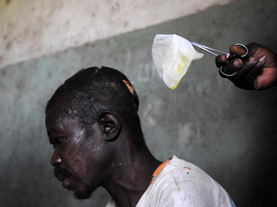 A man with machete wounds to his head from an attack by rebels of the Lord's Resistance Army (LRA) is treated in a hospital on February 21, 2009 in Ngilima, northeastern Congo. 