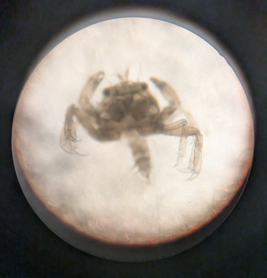 A photo of a small crab larva from a microscope