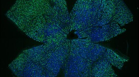 A mouse retina after receiving gene therapy. The treatment led to increased nerve cell electrical activity and a notable increase in visual acuity.
