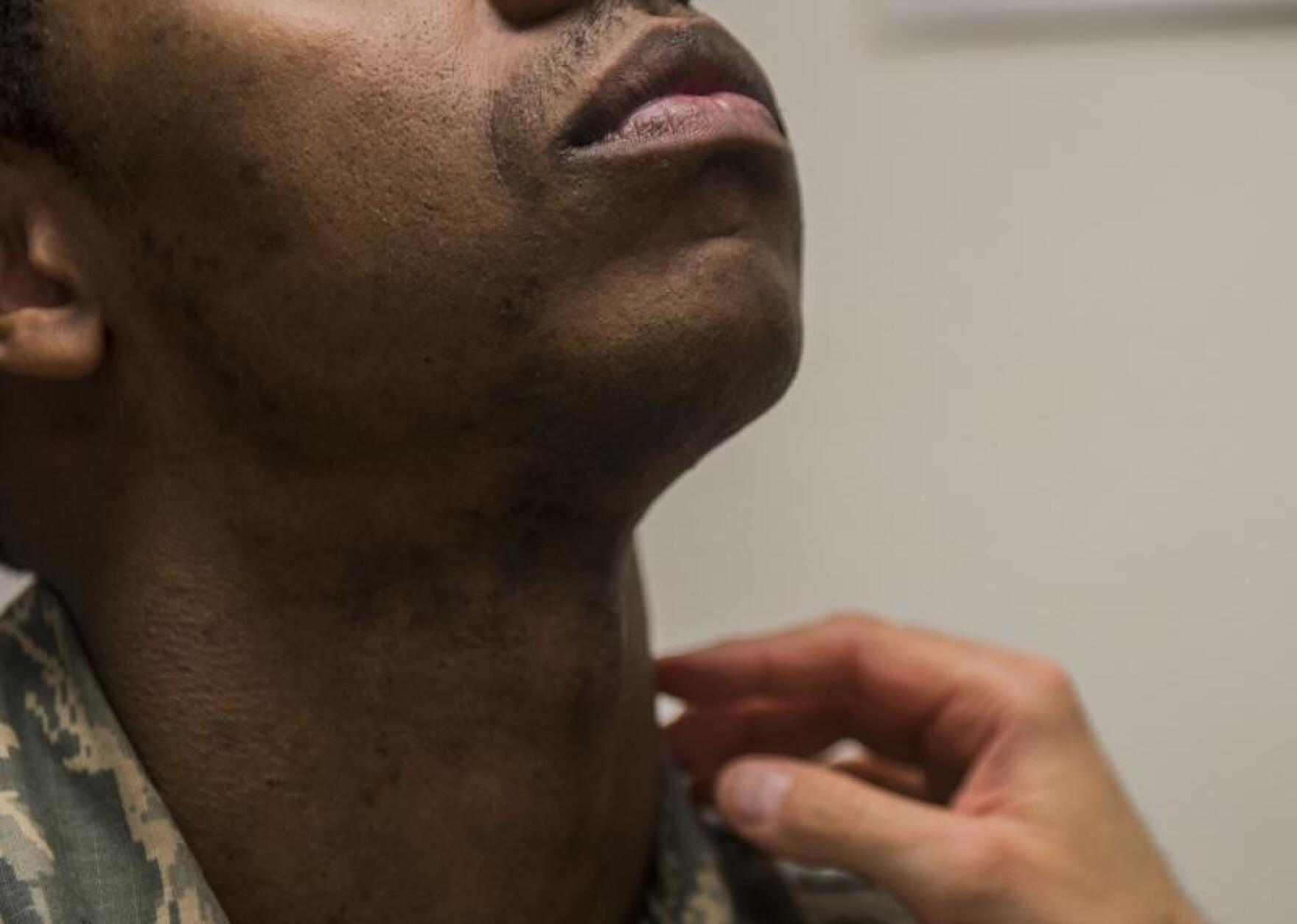 A Skin Condition Makes It Hard For Some Black Men To Shave — And Get