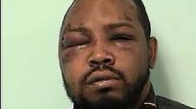 Melvin Jones III was left permanently disfigured by the assault by Jeffrey Asher