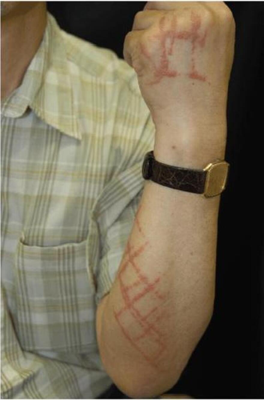 Spray Lights Up The Chemical That Causes Poison Ivy Rash | WVXU