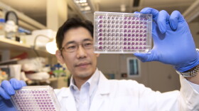 UC cancer researcher Atsuo Sasaki has unlocked the feeding mechanism important for tumor growth. 