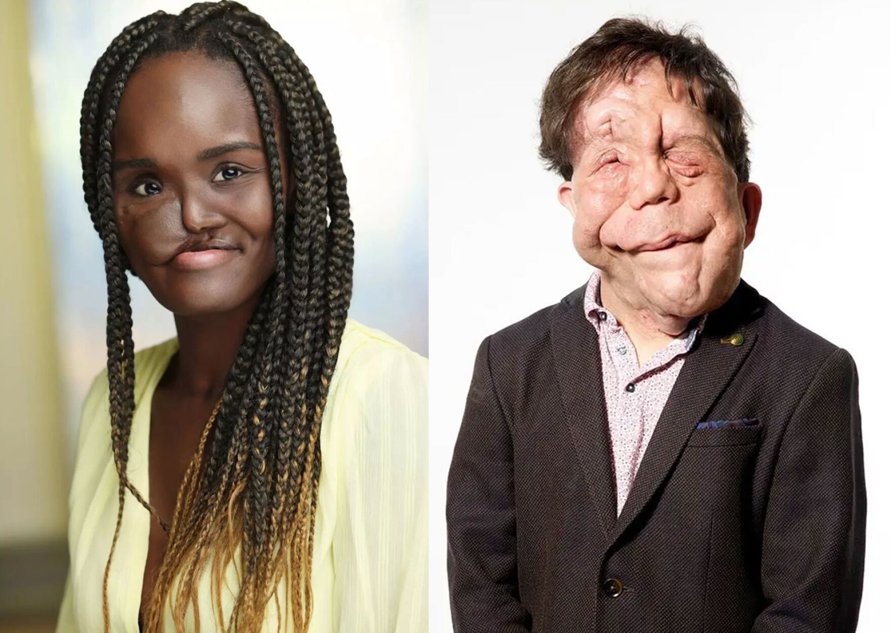 Adam Pearson and Crystal Marshall are changing the faces of acting