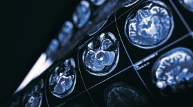 FILE: MRI of brain, concept of the mysteries of the human mind.