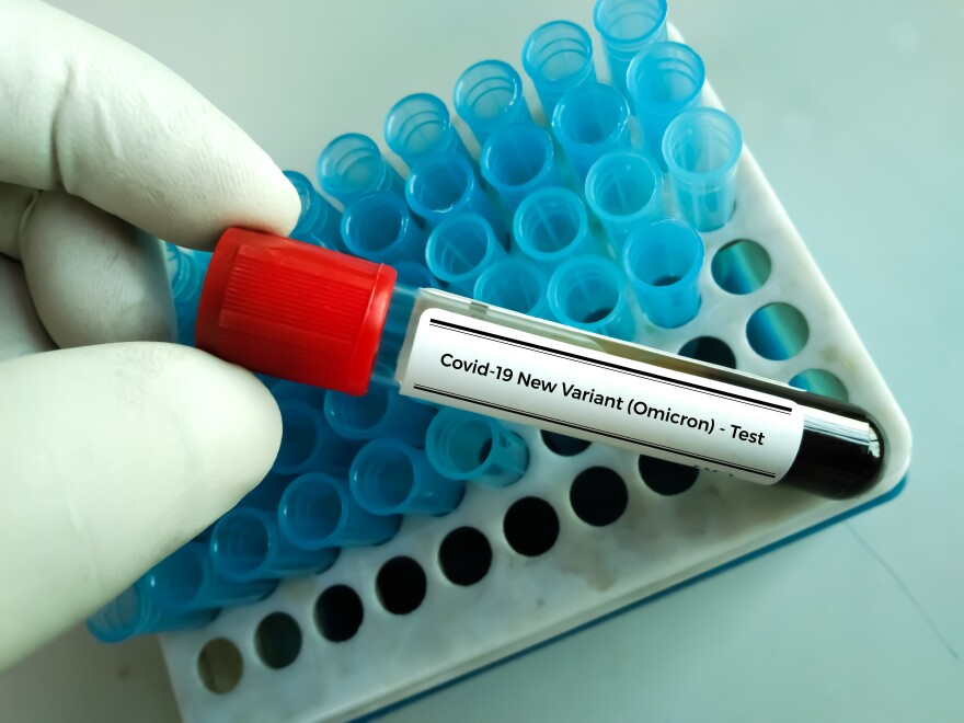 Researcher holds blood sample for New Variant of the Covid-19 Omicron