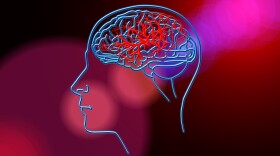 A new study finds the normal blood flow to the brain is cut dramatically when a person is overweight.