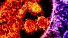 A colorized micrograph of MERS, a member of the coronavirus group along with the 2019 Wuhan strain