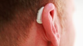Hearing aids are expensive, and they're not covered by Medicare or many private insurance plans. (Joern Pollex/Getty Images)