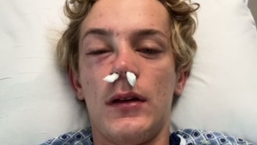 19-year-old hate crime victim Michael White in the hospital following his attack