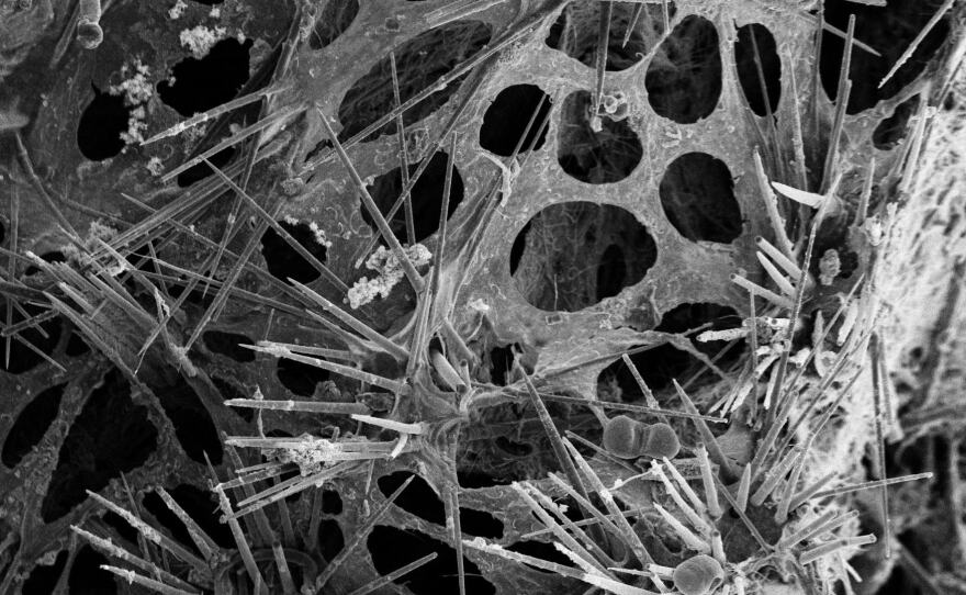 Scanning electron microscope image of Desmacella alaskensis, one of the newly discovered sponges. Here spicule brushes protrude through the surface and ectosomal membrane.