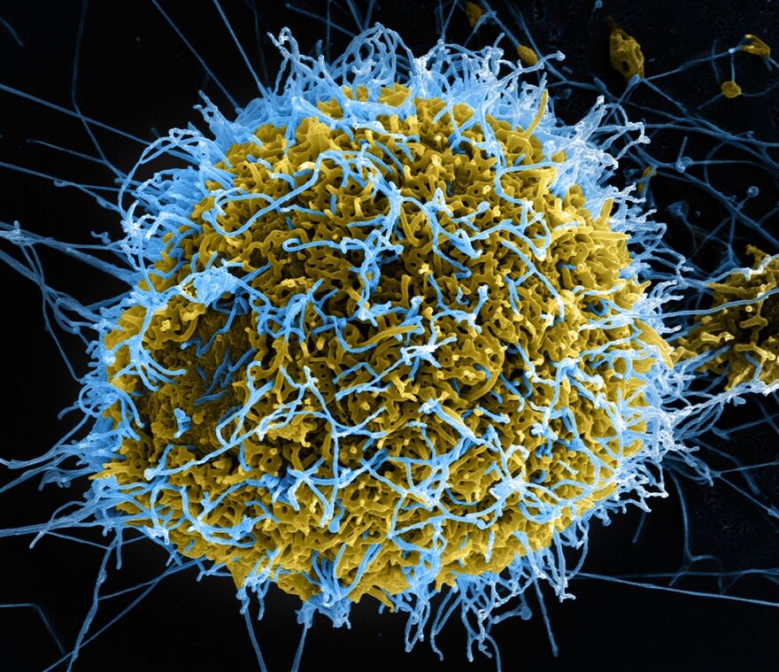 This colorized scanning electron micrograph image shows filamentous Ebola virus particles (shown in blue) infecting a cell (shown in yellow-green).