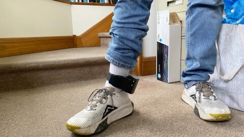 An ankle monitor worn by a man detained during an Immigration and Customs Enforcement operation in Lake Placid on May 28, 2026