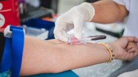 Checking for hsCRP involves a simple blood test.