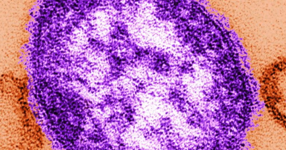 Third measles-related death in Pa. reported in Jefferson County