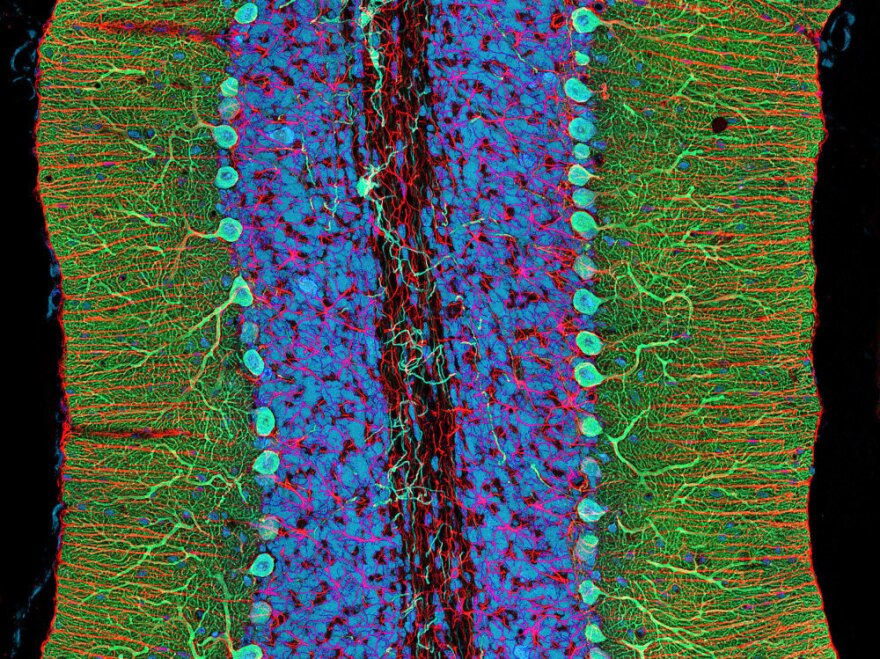 A section of the cerebellum, stained with various laboratory methods. Image from Portraits of the Mind by Carl Schoonover.