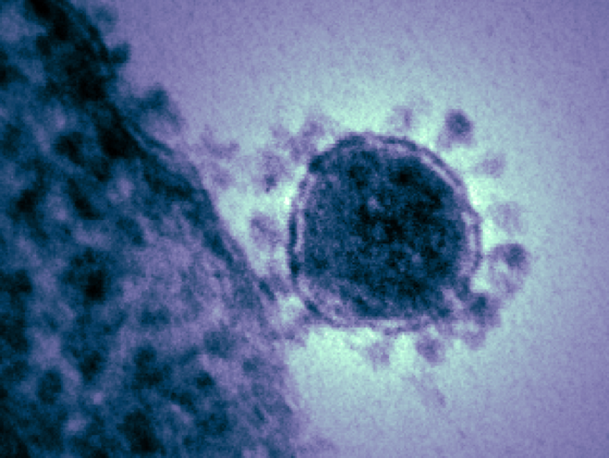 This highly magnified, digitally colorized transmission electron microscopic image reveals details of a single Middle East respiratory syndrome coronavirus, or MERS-CoV. It’s a relative of the novel coronavirus identified in 2019 in Wuhan, China. (Public domain image courtesy National Institute of Allergy and Infectious Diseases)