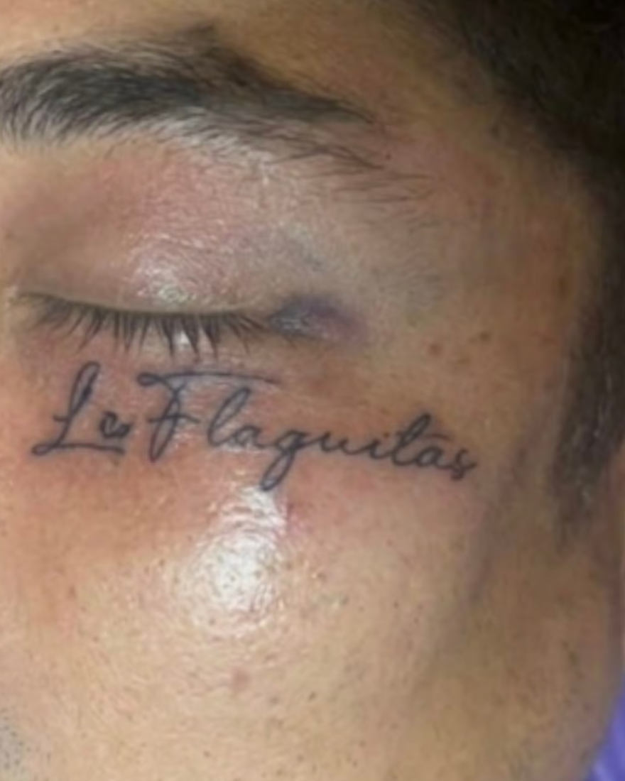 A screenshot of Jacob Baker's tattoo under his left eye.