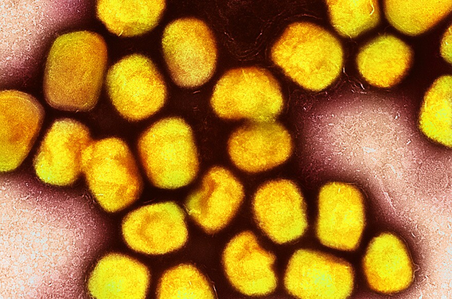 Colorized transmission electron micrograph of monkeypox virus particles (yellow) cultivated and purified from cell culture. Image captured at the NIAID Integrated Research Facility (IRF) in Fort Detrick, Maryland.