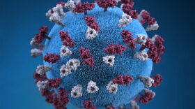 Measles, which was considered eradicated more than 25 years ago, continues to reappear across the United States. Kansas is reporting five measles cases, all associated with out-of-state travel. This is a three-dimensional representation of the measles virus particle.