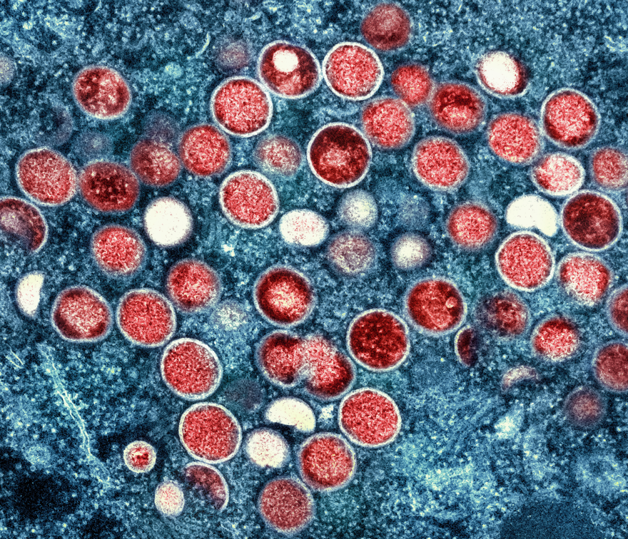 This is a colorized transmission electron microscopic image of mpox virus particles (red), found within an infected cell (blue), that had been cultured in the laboratory. The image was captured and color-enhanced at the National Institute of Allergy and Infectious Diseases (NIAID), Integrated Research Facility (IRF), located in Fort Detrick, Maryland.