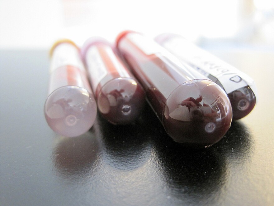 bloodsample.jpg