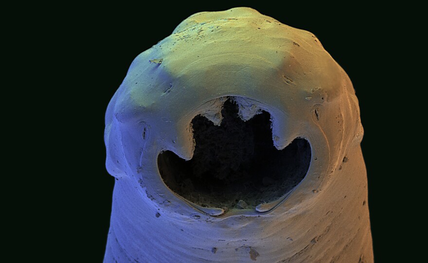 The Old World hookworm, <em>Ancylostoma duodenale</em>, an intestinal parasite. Adult worms feed on the human intestinal lining, leading to blood loss and anemia.