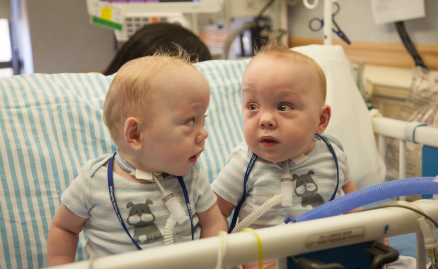 Longest-separated twins find each other - BBC News