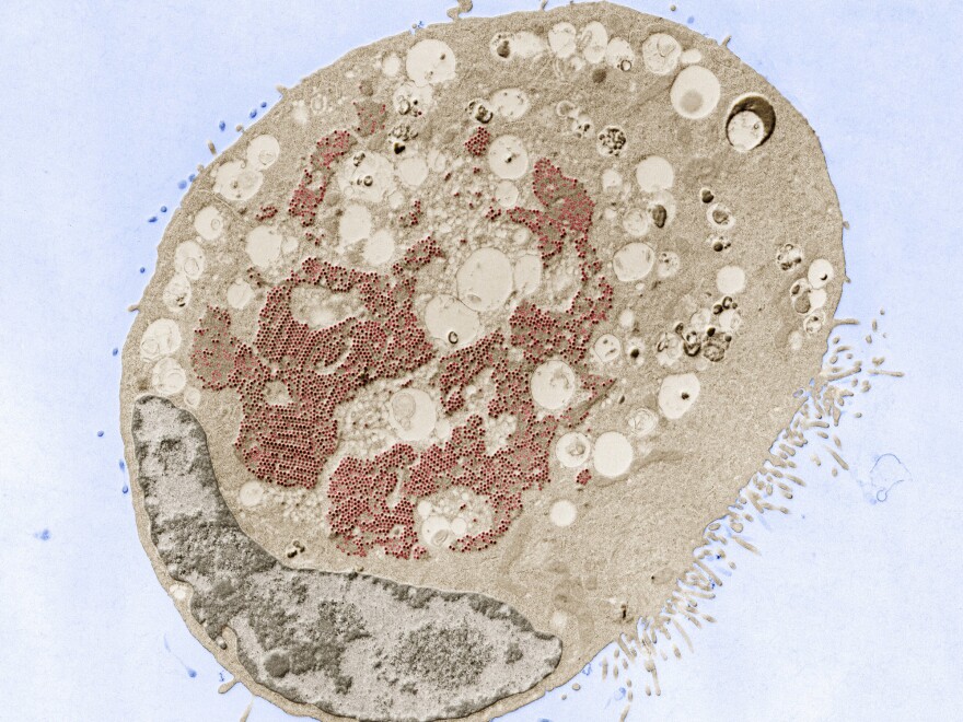 Transmission electron micrograph of a cell infected with reovirus (red). The virus is very common and not considered dangerous. Scientists now think it may have a role to play in triggering celiac disease.