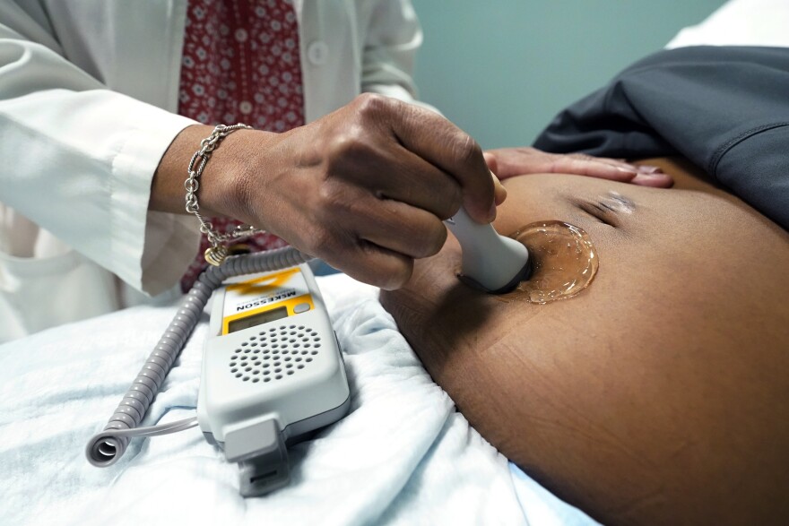 FILE - A doctor uses a hand-held Doppler probe on a pregnant woman to measure the heartbeat of the fetus on Dec. 17, 2021, in Jackson, Miss.