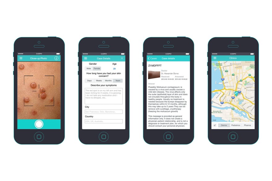 A new app provides people with a first line of advice about whether any of their moles, rashes or skin conditions are dangerous. (Courtesy of First Derm)