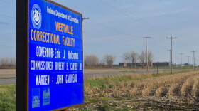 Transgender people in state prisons are currently eligible to receive gender-affirming surgery.
