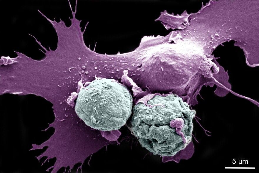 A large dendritic cell beginning to, as Rita Serda said, "internalize/eat/phagocytose" two zombie vaccine cells (image from a scanning electron microscope with false-color added for clarity)
