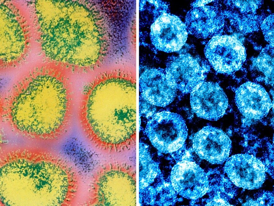 (At left) A colorized electron micrograph image of the influenza virus. (At right) Color-enhanced electron micrograph image of SARS-CoV-2 virus particles, isolated from a patient.