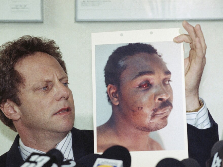 In 1991, Steven Lerman, an attorney for Rodney King, displays a photo of his client during a press conference in Beverly Hills. King was beaten by Los Angeles police officers who were later acquitted, sparking riots across the city.