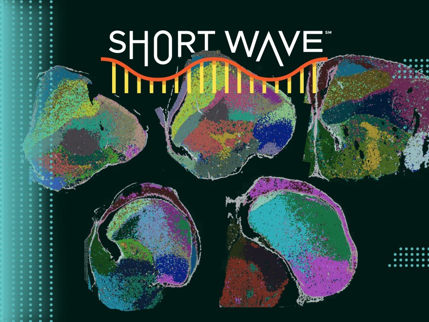 Various cell types in chick brains are color-coded.